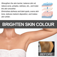 Dark Spot Remover Cream