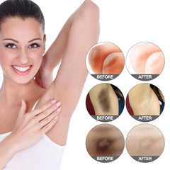 Dark Spot Remover Cream